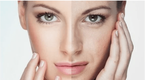 Effective facial rejuvenation