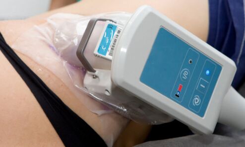Body skin cryolipolysis
