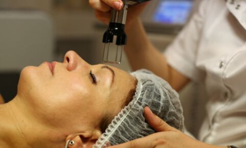 Staged thermal peeling